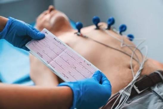 Paciente deitado com eletrodos no peito enquanto o médico segura o traçado de um eletrocardiograma